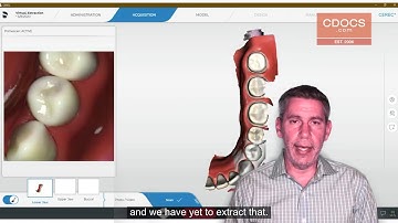 Tip of the Day: Virtual Extraction