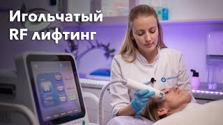 Аппарат фракционного РФ лифтинга. Демонстрация проведения процедуры.