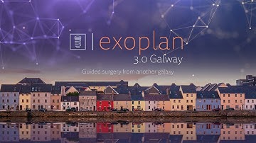 Now available: exoplan 3.0 Galway