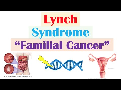 Lynch Syndrome (Hereditary Non-Polyposis Colorectal Cancer) Genetics, Symptoms, Diagnosis, Treatment