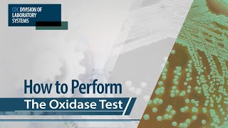 How to Perform the Oxidase Test