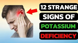 12 STRANGE Signs Your Body Is Seriously Begging For POTASSIUM