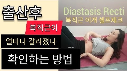 [복직근이개2탄] 출산후 복직근 갈라짐 셀프체크 자가진단 방법 Diastasis Recti