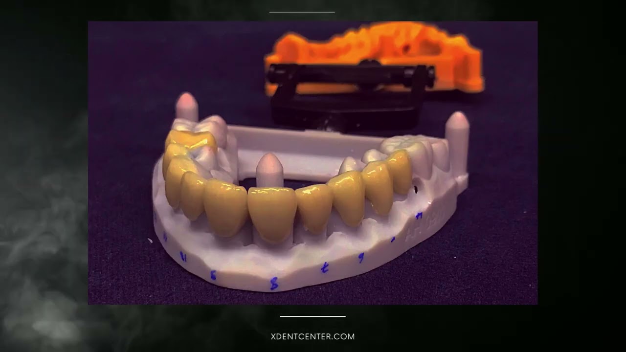 Xdent Dental Outsourcing Products YouTube