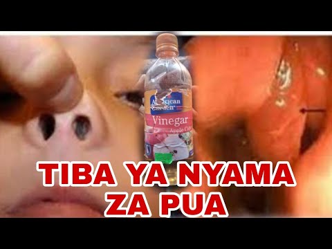 tiba-ya-nyama-za-pua-youtube