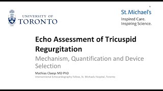 Echo Assessment of Tricuspid Regurgitation – Mechanism, Quantification and Device Selection