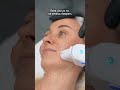 Женщина не определённого возраста! #аппаратнаякосметология