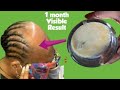 Use This 4 Ingredients Twice A Week For Fastest Hair Growth At Home |Grow Your Hair Fast And Thick
