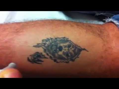 crema rimozione tatuaggi | Doovi