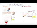 Urinary tract infection uti  classification etiology  clinical manifestations