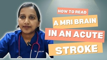How to Read a MRI in an Acute Stroke