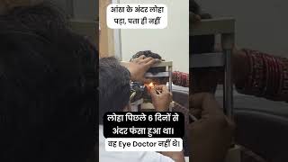 Iron Gone In Eye (6 Days)- See What Next | Dr. kartik Gupta | Eye Doctor In Palam |89200 90907