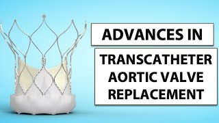 Patient Webinar: Advances in Transcatheter Aortic Valve Replacement (TAVR) screenshot 3