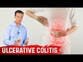 What is Ulcerative Colitis? – Causes, Symptoms & Treatment by Dr.Berg