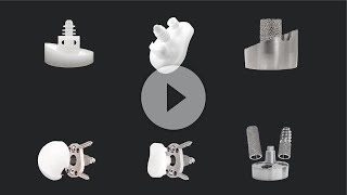 Glenoid Treatment Options: Managing Complex Morphology With Augmented Implants