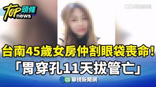 割眼袋喪命！　台南45歲女房仲「胃穿孔11天拔管亡」｜華視新聞 20260907 @CtsTw