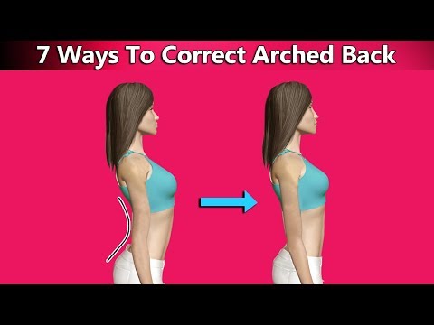 7 Ways To Correct Sway Back Or Arched Back