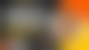 Fracture Dislocation of the Shoulder, Analysis & Lesson learnt by Dr Nicholas Antao