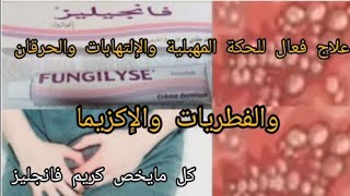 FUNGILYSE كريم طبي مضمون 100% لعلاج حكة المهبل والإلتهاب والاحمرار والإكزيما/مكوناته/موانعه/ثمنه