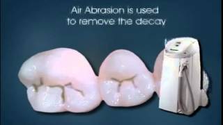 Pediatric Dentist Sarasota