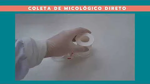 Como é feito o exame micológico direto?
