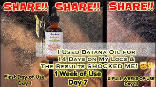 Detailed I Used Batana Oil for 14 Days on My Locs & The Results SHOCKED ME! 🤯✨ Details