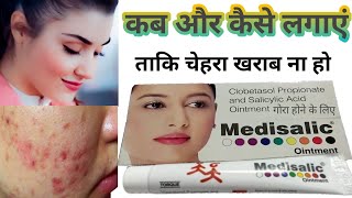 Medisalic Ointment Cream Review in Hindi 2022 | गोरेपन की क्रीम, मेडिसेलिक क्रीम के फायदे और नुकसान