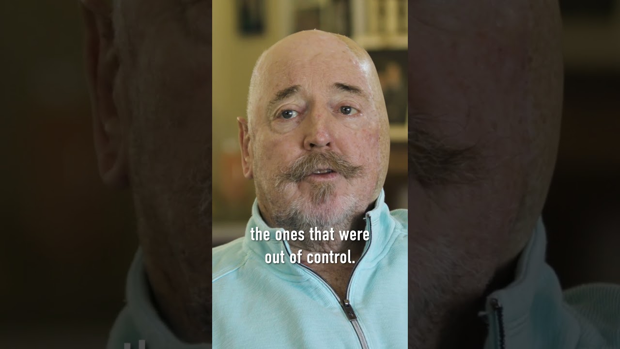 Half of Doug's face had to be removed because of his 