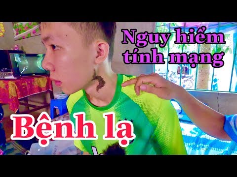 Video Căn bệnh 