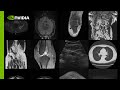 Create infinite medical imaging data with generative ai