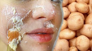 КАРТОФЕЛЬНАЯ МАСКА ДЛЯ ЛИЦА 🥔 Как бюджетно отбелить кожу и убрать морщины 🌴 POLI NA PALME