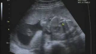 100309-3-3.wmv