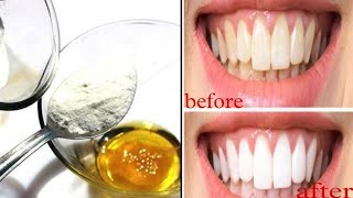 दांतों सफेद करने का अनोखा तरीका मोती आज तक नहीं देखा होगा देगाteeth cleaning in only 5 minutes