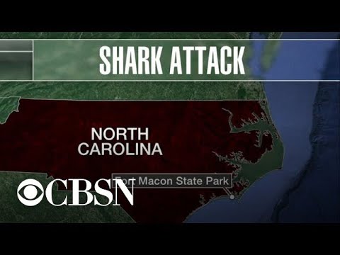 Teen survives shark attack in North Carolina