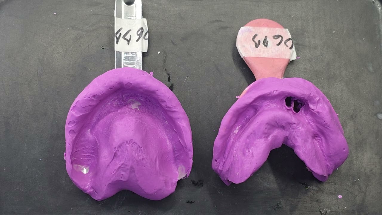 Vazamento de Gesso  para Moldeira Individual
