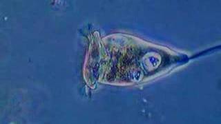 Vorticella Feeding