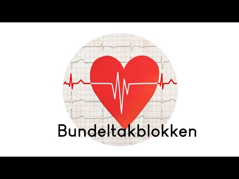 Video: 3 manieren om hartblokken te identificeren