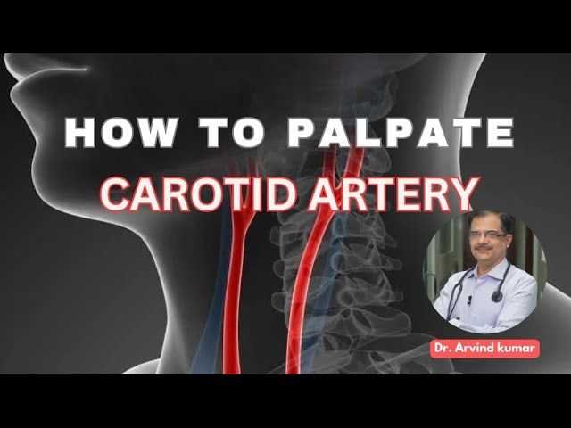 Carotid artery palpation method | Dr Arvind Kumar class=