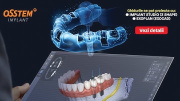 Chirurgie Ghidata ONE GUIDE KIT