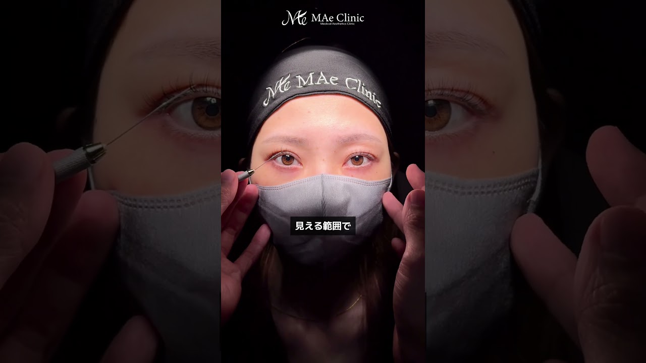 How to Fix Uneven Eyelids in 15 Minutes - YouTube