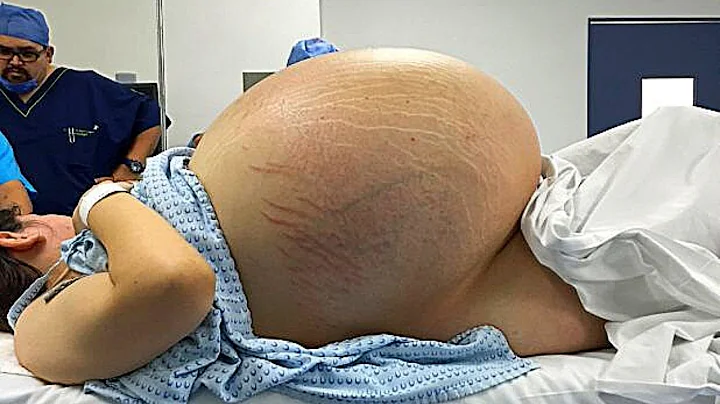 Woman Cant Give Birth, Then Doctors Realize Whats ...