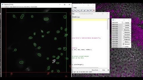 Cellpose + counting frame 2D