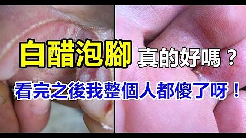 「白醋泡腳」好嗎？ 看完之後我整個嚇傻了呀！ - 天天要聞