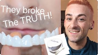 The TRUTH about TruSmile Veneers screenshot 4