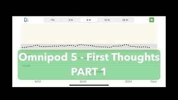 Omnipod 5 - First Thoughts PART 1