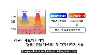 About Mycosis laser by Medicell