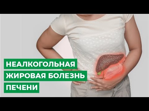 Неалкогольная жировая болезнь печени