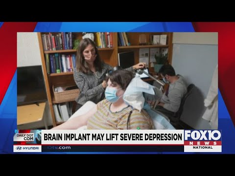 Brain implant delivers 'jolt' to help treat depression