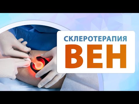 Склеротерапия при варикозе Флеболог Москва