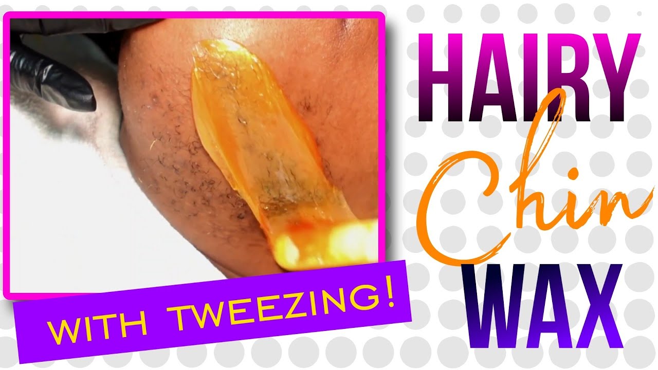 Депиляция волос на подбородке (гирсутизм) с помощью пинцета